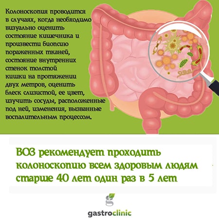 Колоноскопия в Алматы